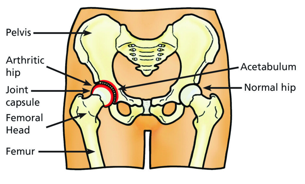 Image showing the hip joint.  