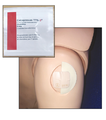 Photographs of the clonidine patch packet with red strip on the label and the patch with half of the cover patch removed applied to the skin
