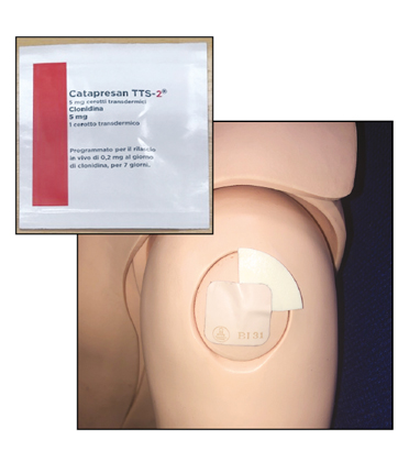 Photographs of the clonidine patch packet with red strip on the label and the patch with three quarters of the cover patch removed applied to the skin
