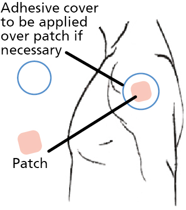 Diagram of a person side on with patch applied to the upper arm and cover patch applied on top