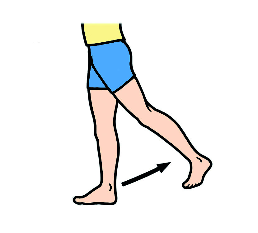 Image showing how to do this exercise;



Make sure you do not turn your foot outwards or lean to the non‑operated side. Stand with your feet hip width apart. Gently lift your operated leg behind you keeping your knee straight. Hold for a few seconds and slowly lower.