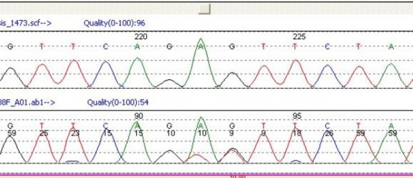Sanger sequencing showing KIT exon 9 mutation in a GIST
