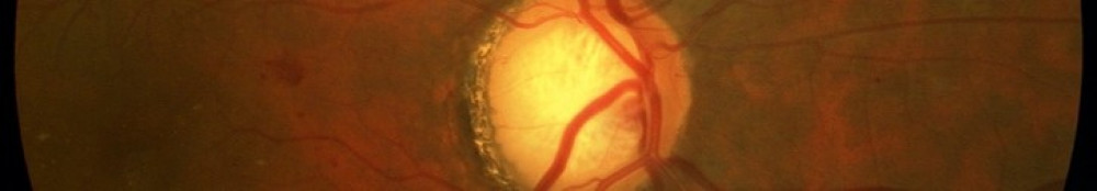 Close up of a retina