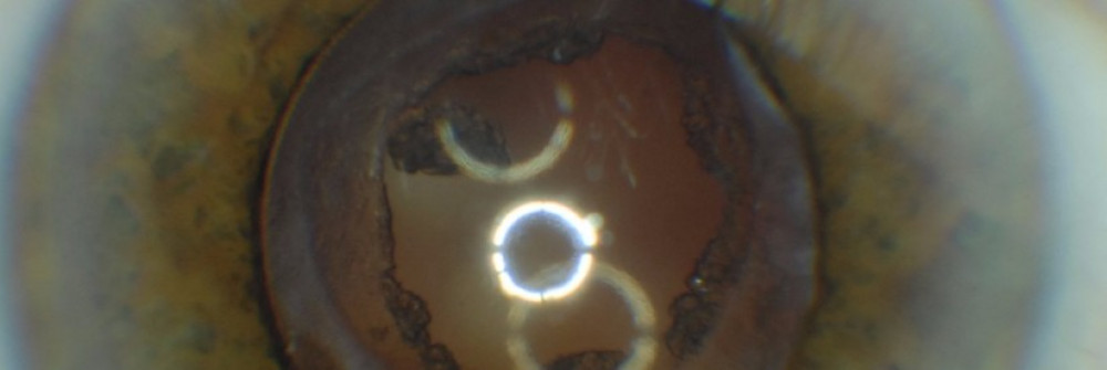 extreme close up of an eyeball