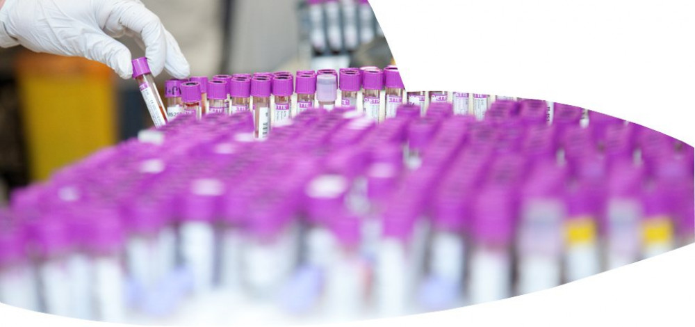 Test tubes