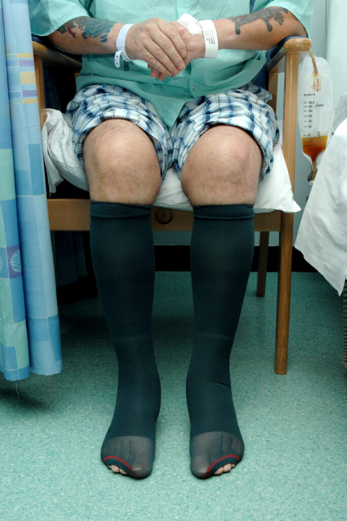 Photograph of a person sat in a chair wearing stockings on their legs