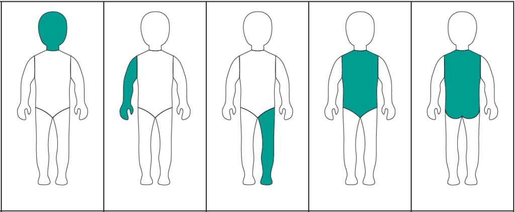 Diagrams showing how many adult FTUs of steroid (cream or ointment) are required to cover each area of the child&rsquo;s body.