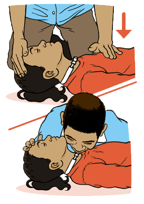 An adult giving 30 compressions to 2 breaths at 2 compressions per second as there is no response. 