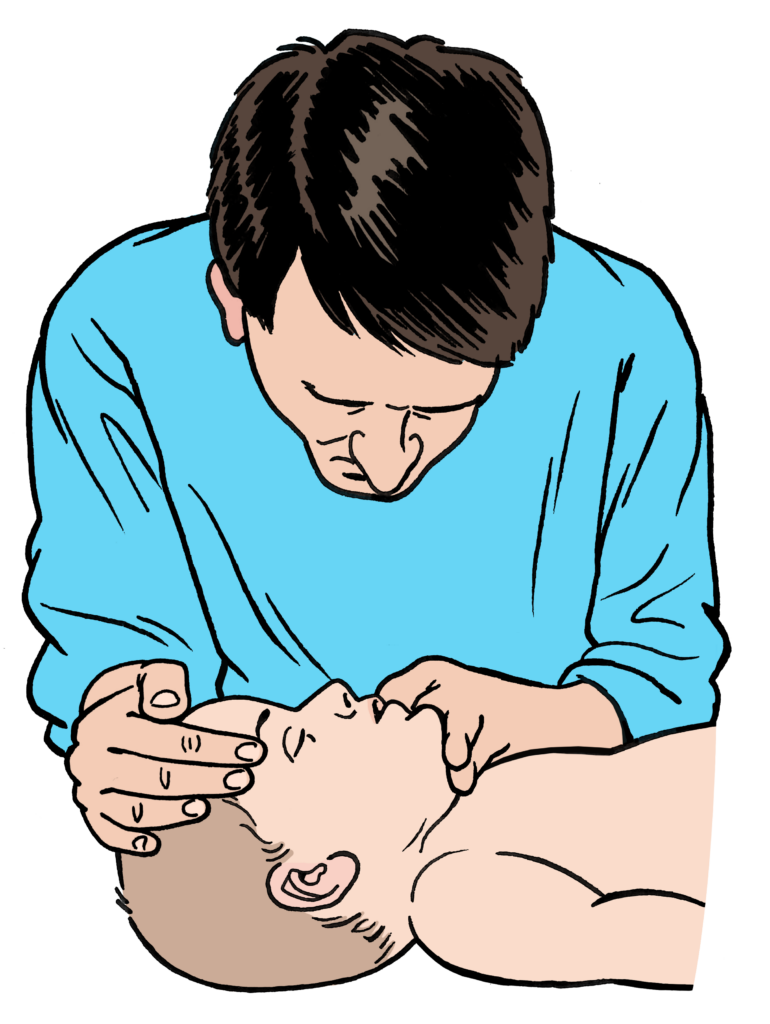 An adult putting the airway in to a &lsquo;neutral position&rsquo;.