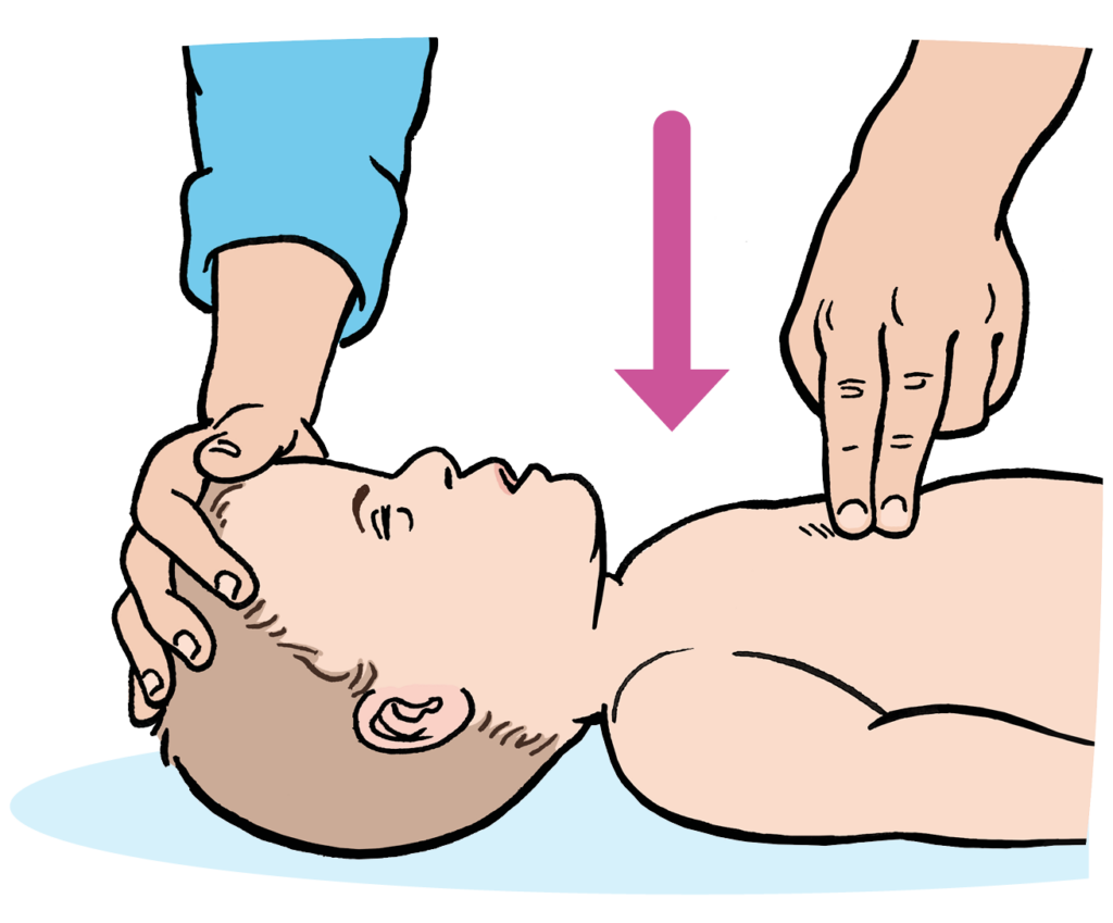 An adult giving 30 compressions to 2 breaths at 2 compressions per second as there is no response. 