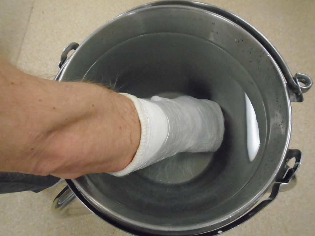 An image of a cast being soaked in warm water.