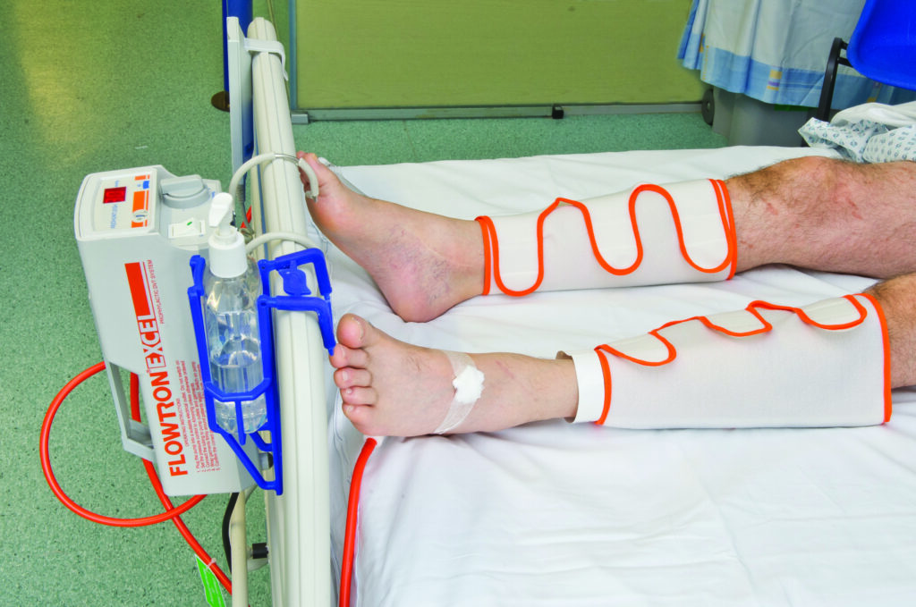 Photograph of a pair of legs with a pumping device wrapped around them