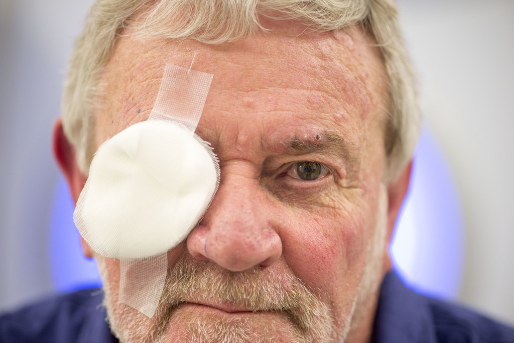 A photograph of a patient wearing an eye patch after removal of an eye shield.