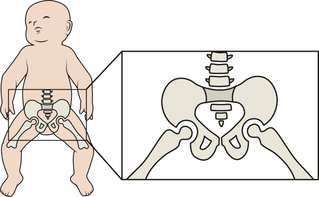Image of the hip joint in a child.