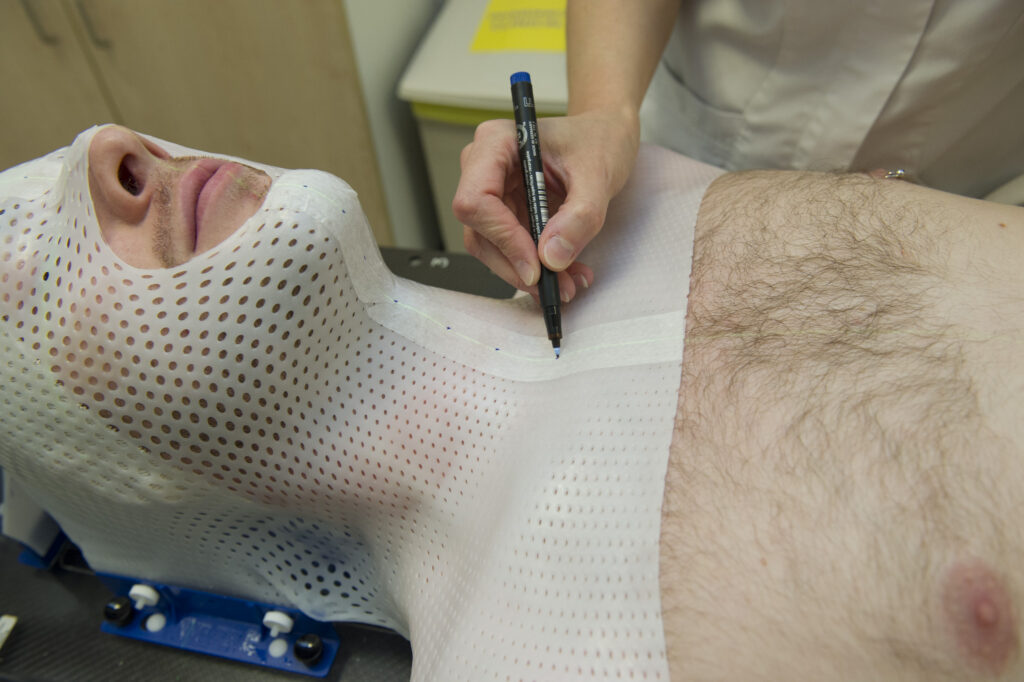 photo of patient in radiotherapy mask