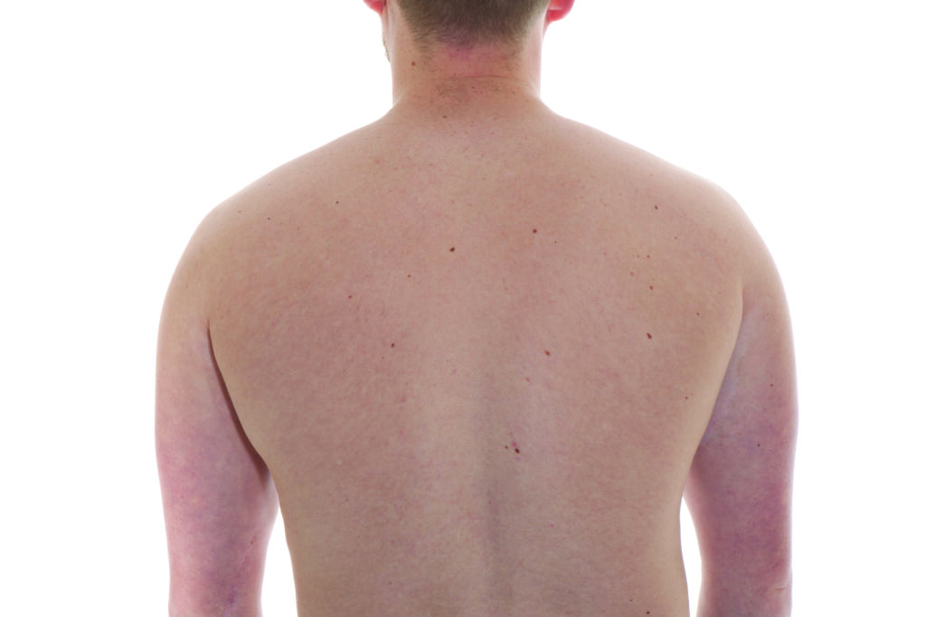 Photograph of a persons back with arms relaxed