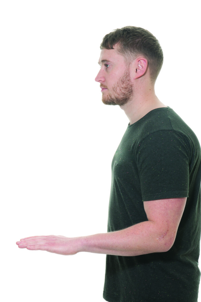 Photograph of a person with their arm bent at the elbow with their palm out facing downward