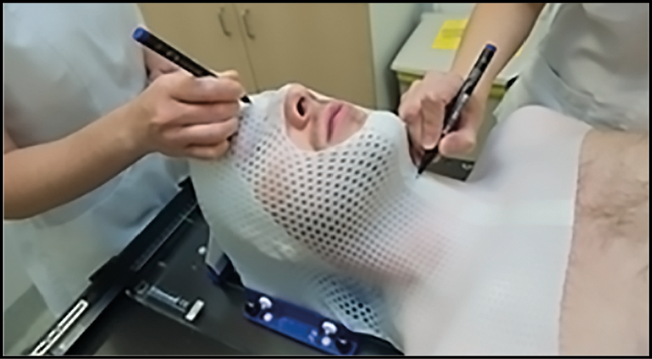 Mould Room staff drawing marks on a radiotherapy mask