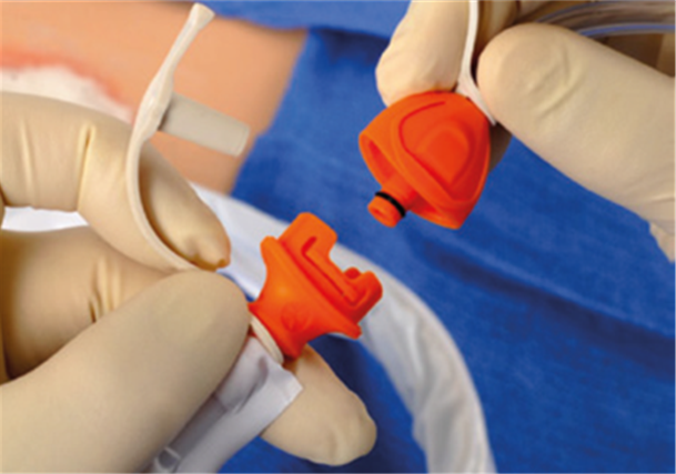 A photograph that shows the connection of the tube to the machine.