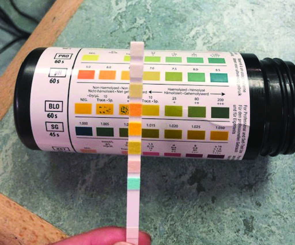 Photograph of a Multistix 8SG test strip and key to identify whether there is blood or protein in the urine.