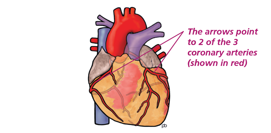 Illustration of the heart with arrows pointing to 2 of the 3 coronary arteries 