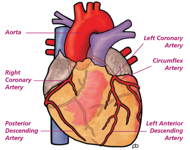 Illustration of the heart with arrows pointing to the aorta, left and right cornary artery, circumflex artery, posterior descending artery and left anterior decending artery
