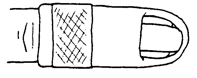 Image showing a splint in position.