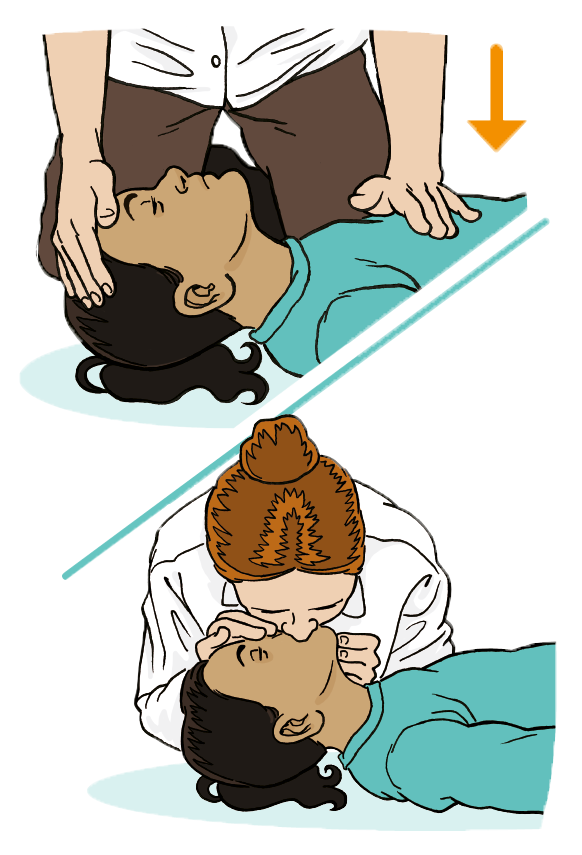 An adult giving 30 compressions to 2 breaths at 2 compressions per second as there is no response. 