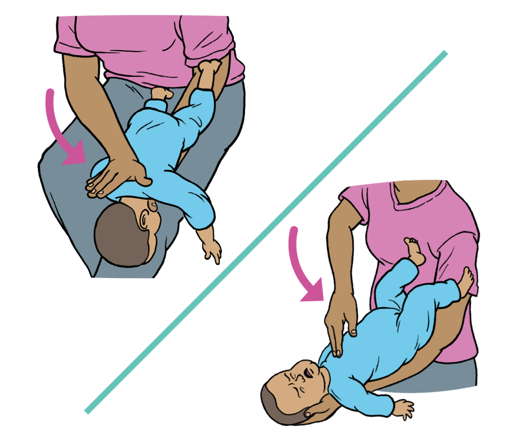An adult repeating steps 4 and 5 as the baby is still choking.
