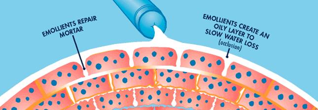 Illustration showing how moisturisers and emollients act as a protective barrier.