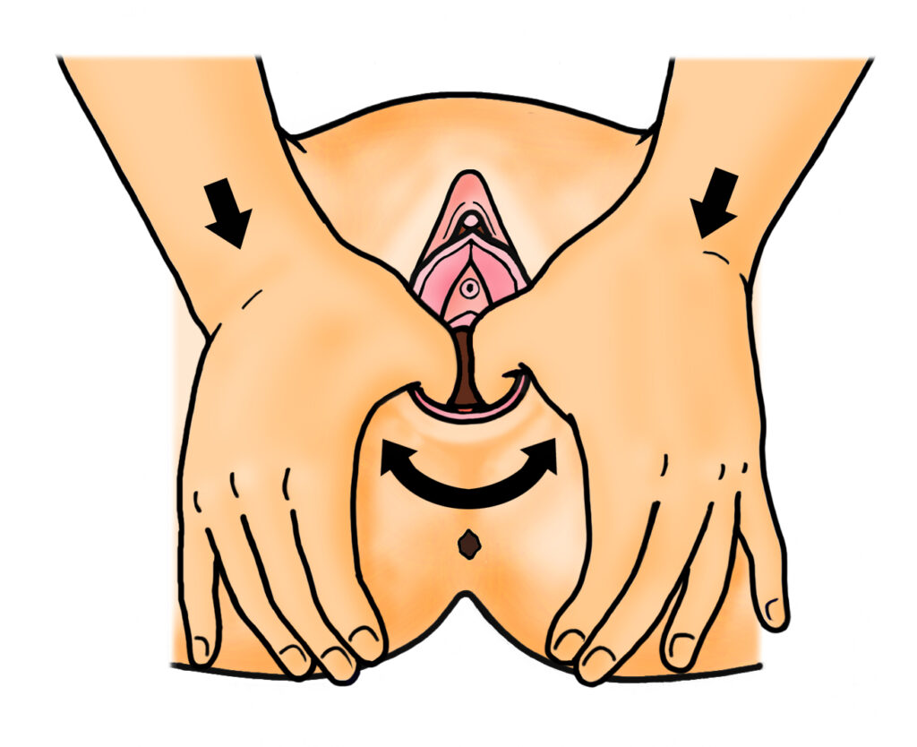Illustration showing how to do perineal massage.