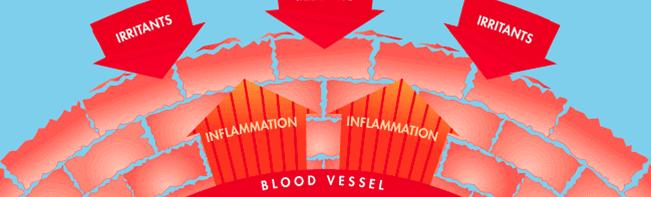 An illustration showing inflammation and irritants on the skin.