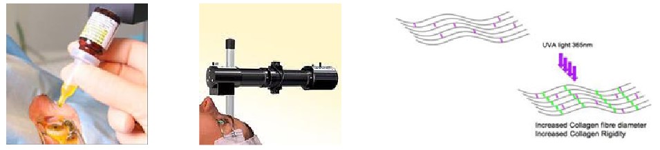 A set of three images showing the procedure process.