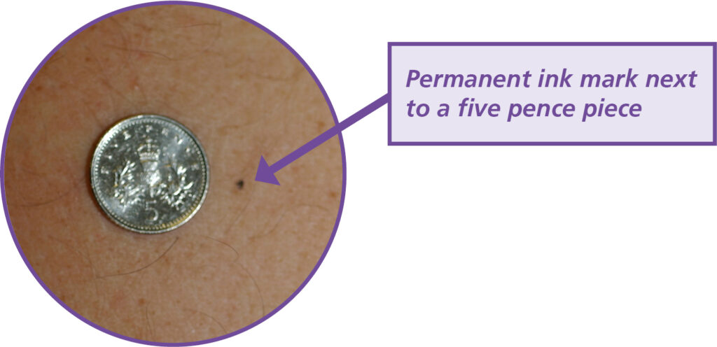 Image of a permanent ink mark next to a five pence piece.