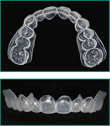 Two photographs against a black background of bleaching trays for teeth whitening. One photo is from the front, the other from above.