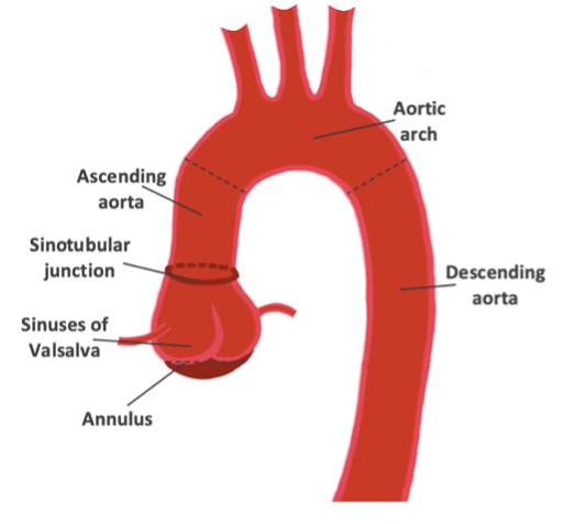 Figure 2 an illustration diagram of six measurements along the thoracic aorta