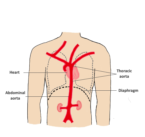 Figure 1 an illustration diagram of the thoracic aorta part of the aorta that is in your chest
