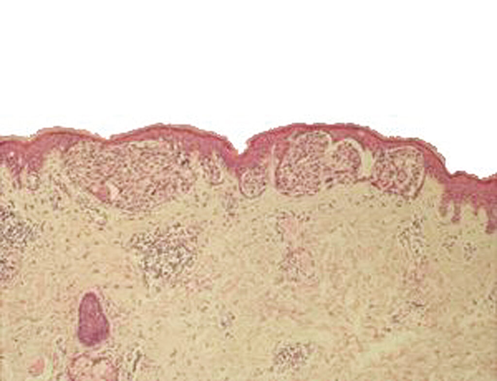 Photograph of a section of skin sample