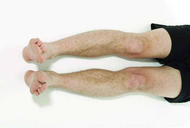 Photograph showing the 'Hip Slide' exercise.