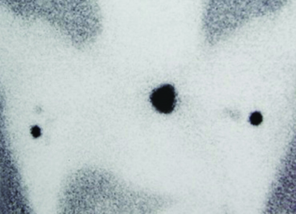 Image of a scan produced from the gamma machine