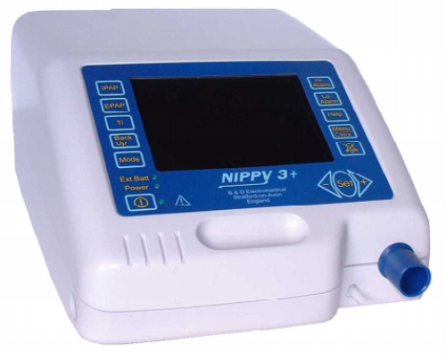 Photograph of a ventilator monitor