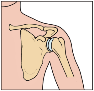 Normal shoulder joint