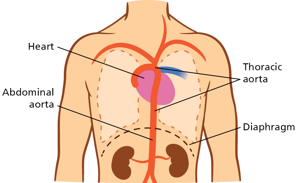 Anatomical illustration of the location of the aorta in the body.