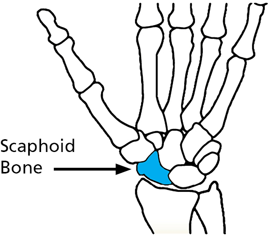 Illustration of the Scaphoid bone.