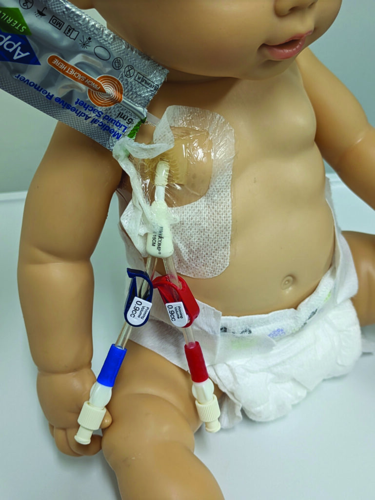 Image C. Use Appeel if needed to remove old dressing.