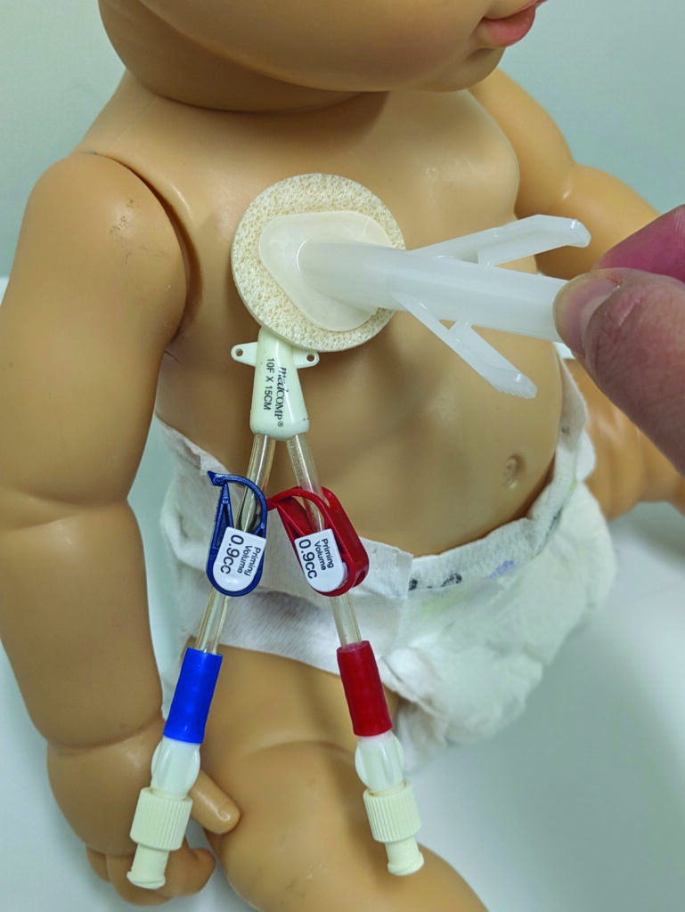 Image D. Clean the area with Chlorprep for 10 seconds.