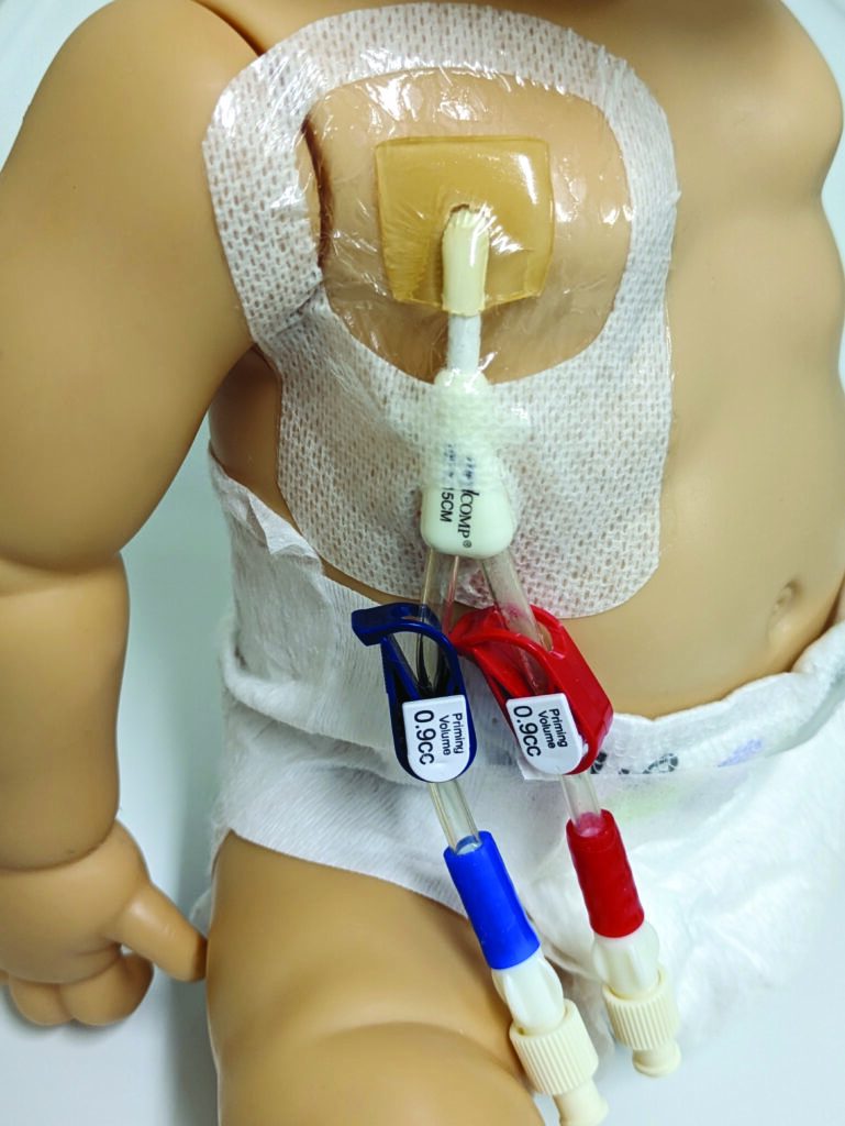 Image F. Make sure dressing is stuck securely to skin. Add extra tape if needed.