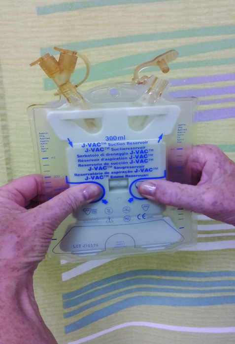 An image squeezing the plates of the J-VAC together