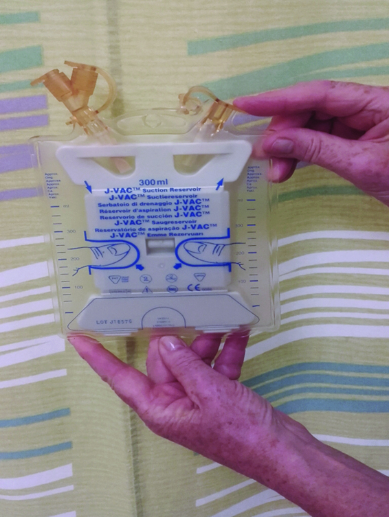 An image showing replacing the bung of the J-VAC