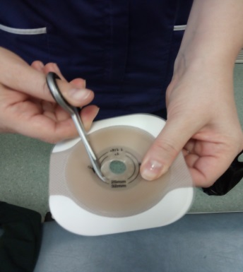 Photo showing the cutting of the hole for the stoma in the new baseplate